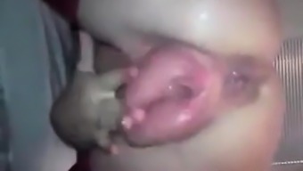 Huge Pumped Pussy Squirting