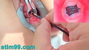 Endoscope Cam in Pee Hole with Semen and Sounding with Dildo